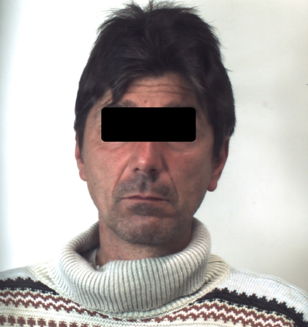 Foggia, accoltellamento a seguito di forte litigio condominiale: arrestato 48enne